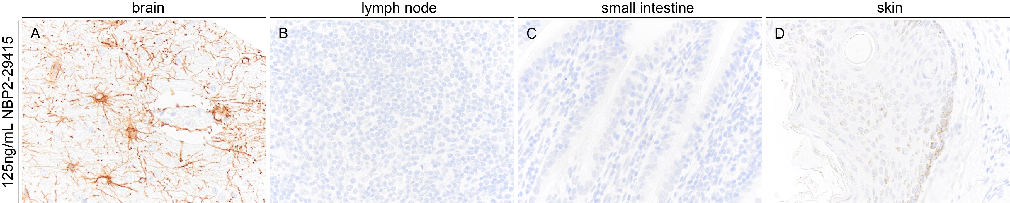 GFAP Antibody (GA-5) NBP2-29415