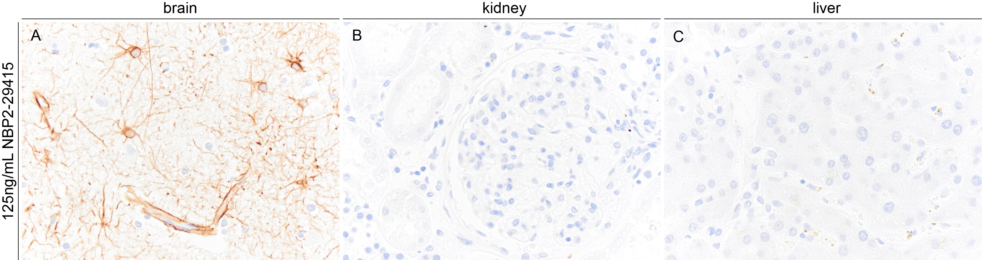 GFAP Antibody (GA-5) NBP2-29415