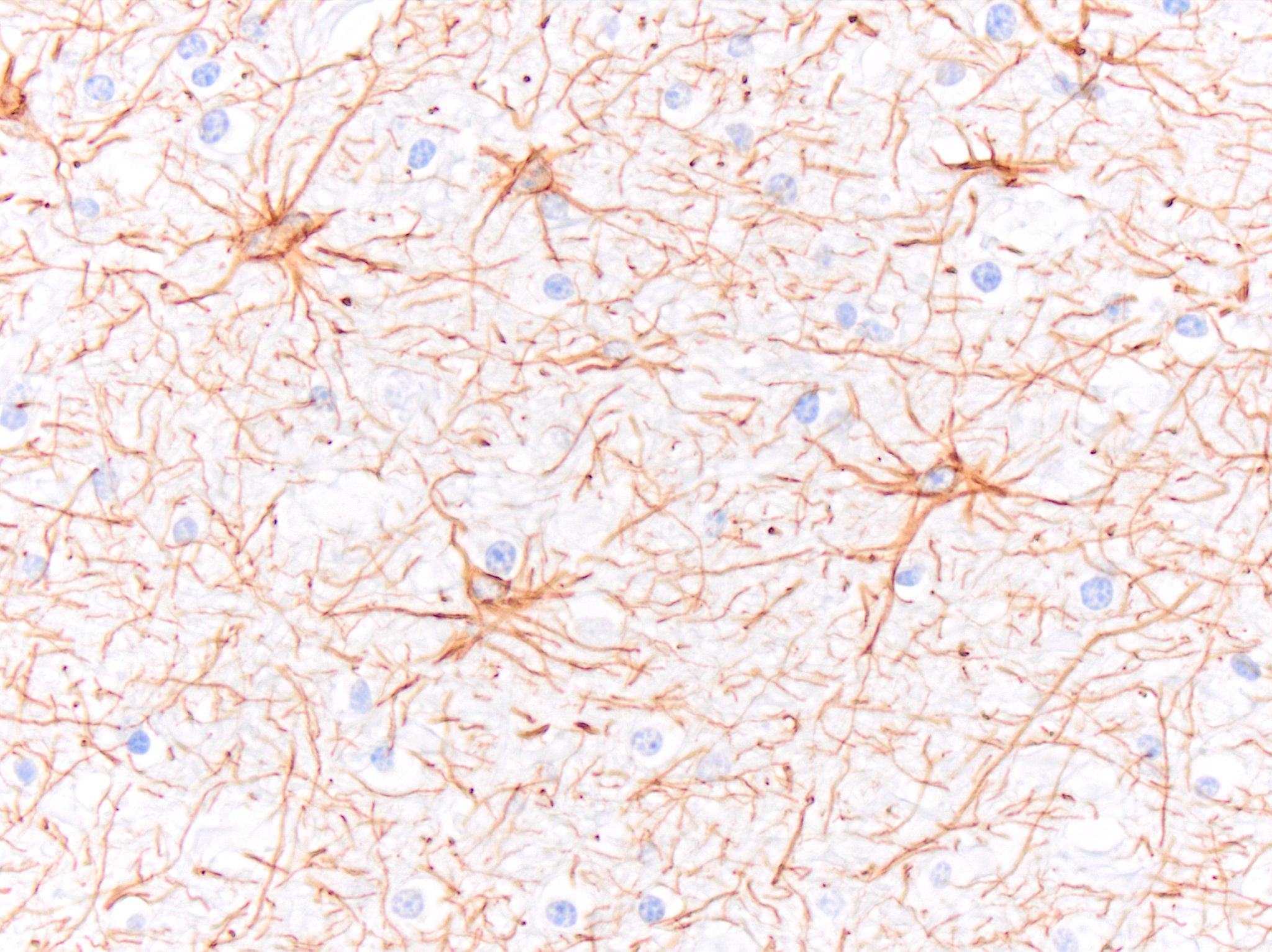 GFAP Antibody (GA-5) NBP2-29415