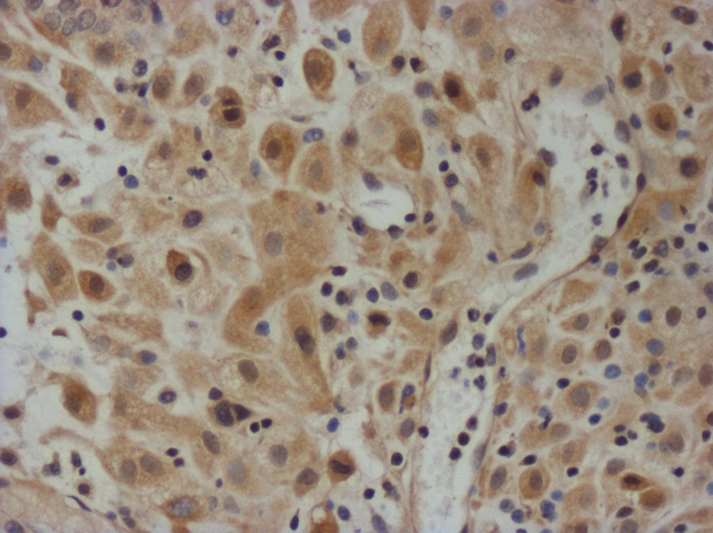 TIMP-3 Antibody NBP2-29478