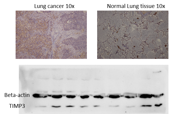 TIMP-3 Antibody NBP2-29478