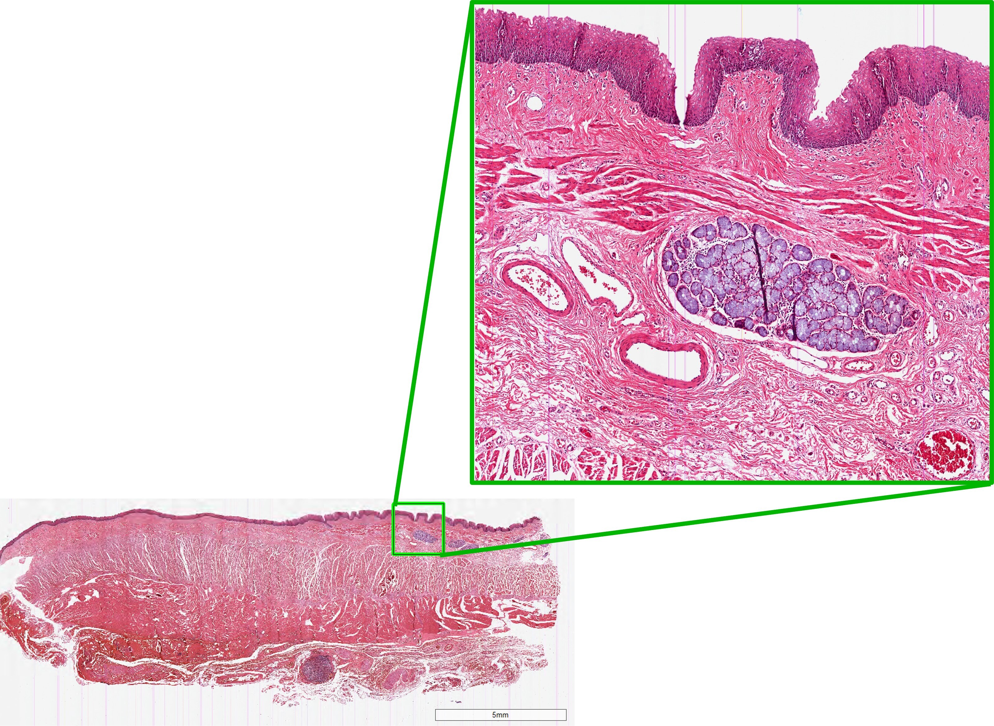 Esophagus Tissue Slides (Normal)- Paraffin NBP2-30178