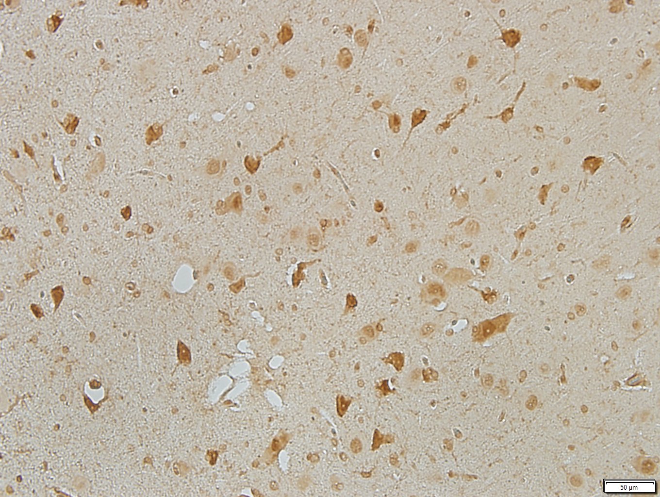 TMEM119 Antibody - BSA Free NBP2-30551