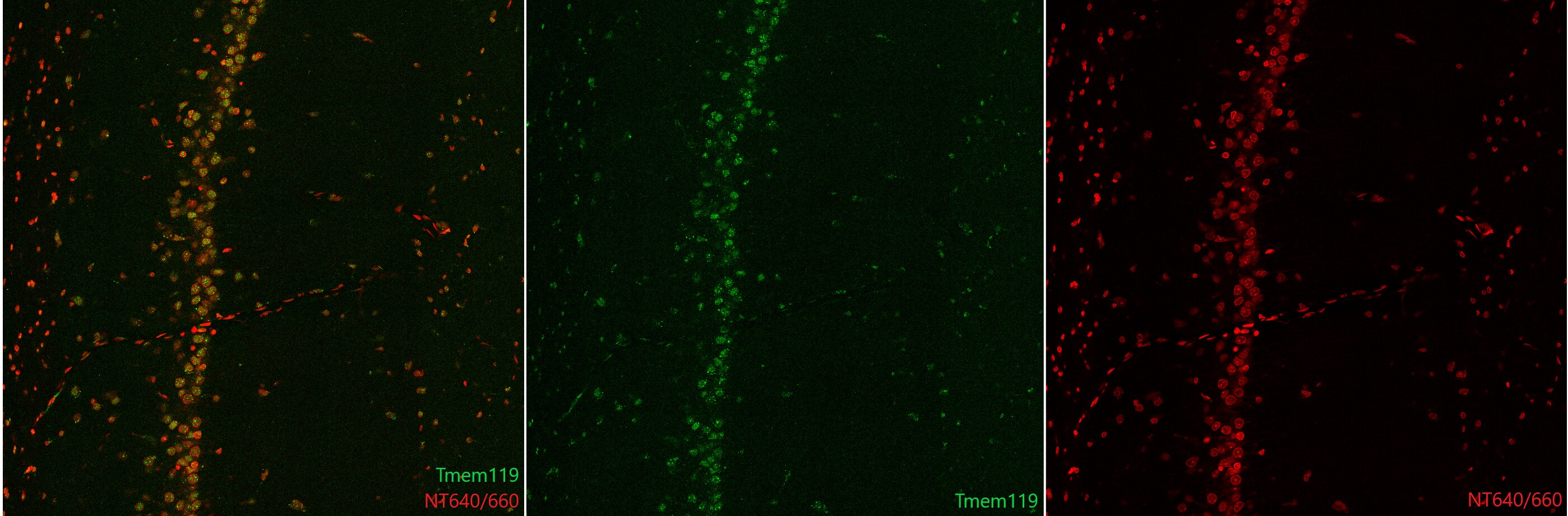 TMEM119 Antibody - BSA Free NBP2-30551