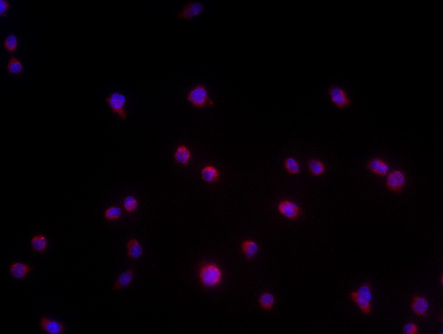 TMEM119 Antibody - BSA Free NBP2-30551
