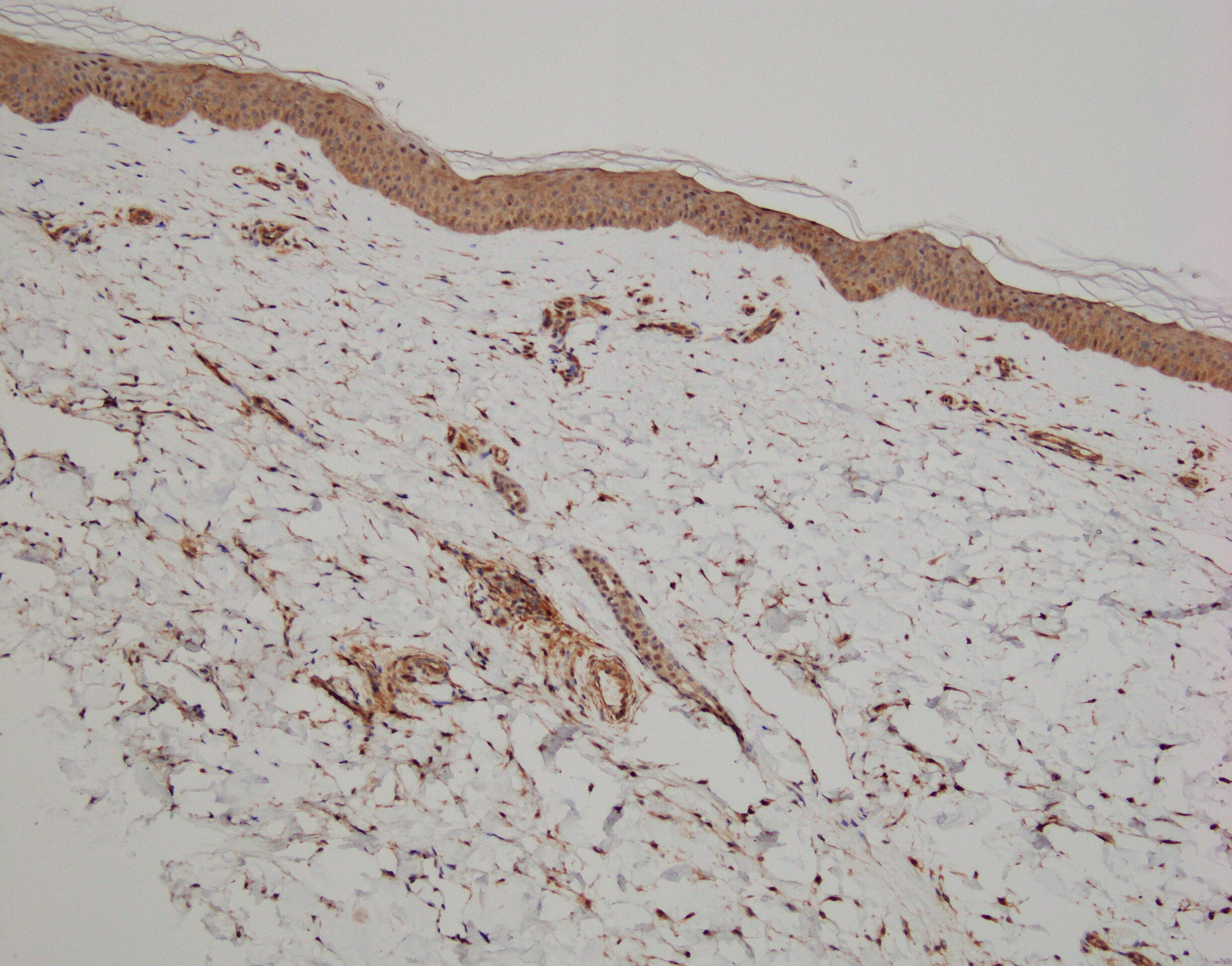 CCR5 Antibody - BSA Free NBP2-31374