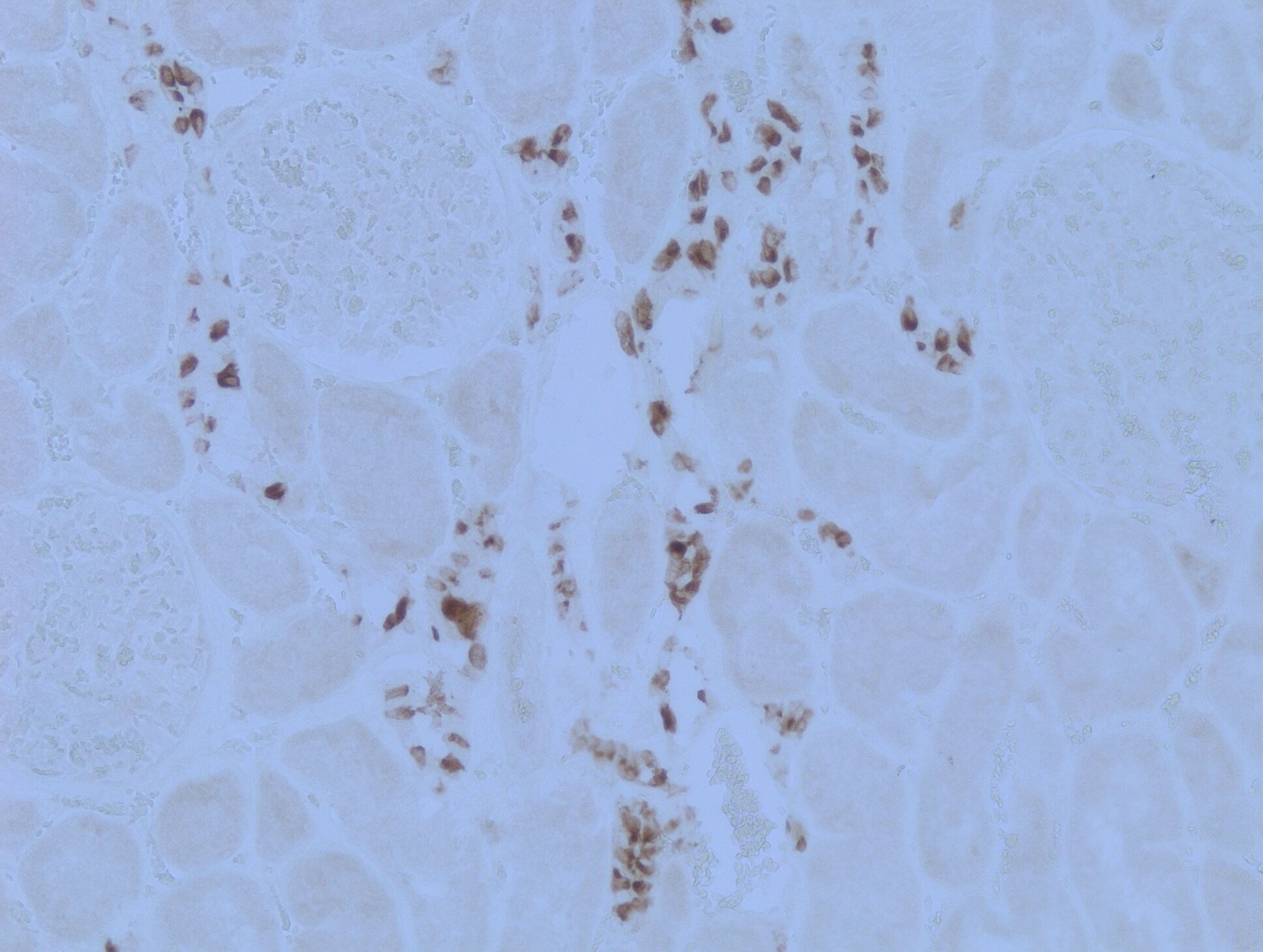 ATP6V0D2 Antibody - BSA Free NBP2-31600