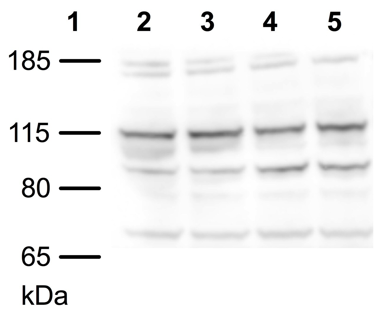Epac2 Antibody - BSA Free NBP2-32009