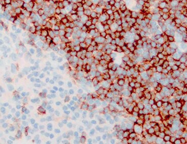 CD43/Sialophorin Antibody (SPM503) NBP2-32822