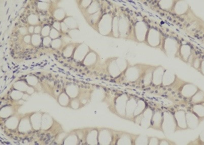 CD68/SR-D1 Antibody (SPM130) NBP2-32831