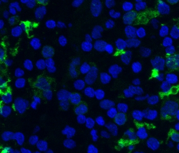 CD68/SR-D1 Antibody (SPM130) NBP2-32831