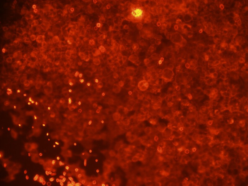 DOG1/TMEM16A Antibody (SPM580) NBP2-32841