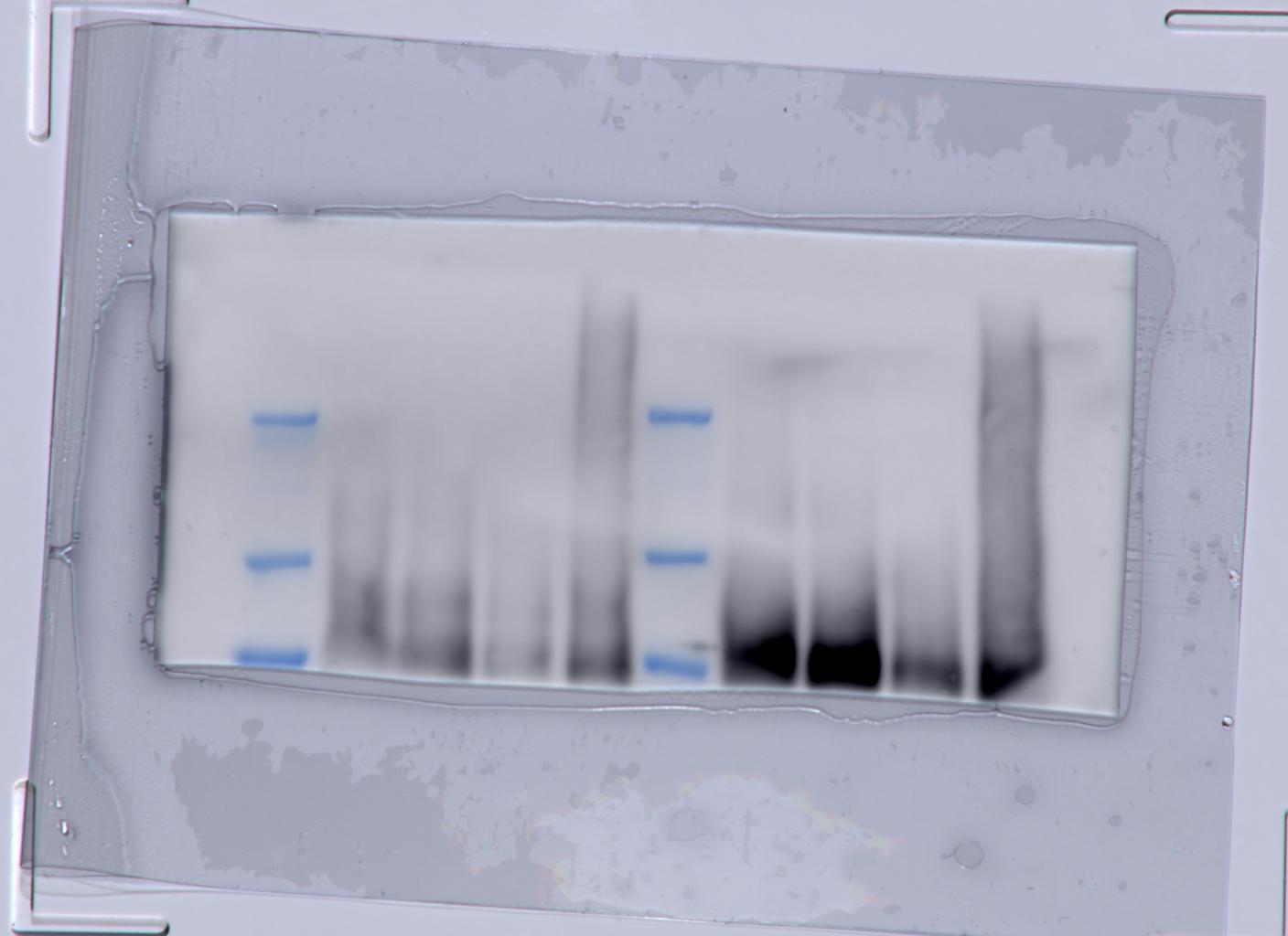 DOG1/TMEM16A Antibody (SPM580) NBP2-32841