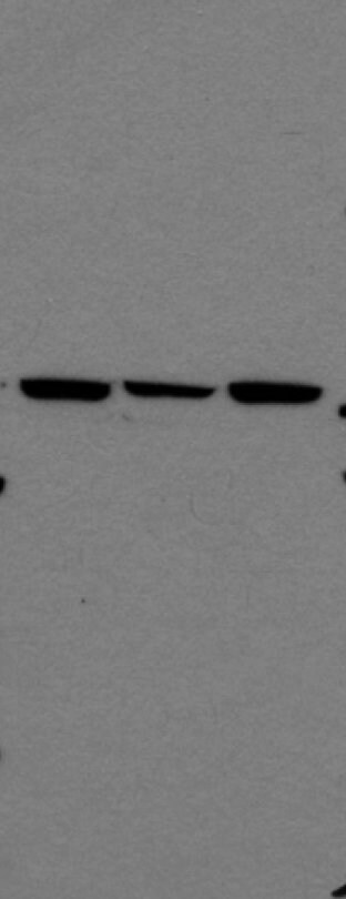 Ornithine Decarboxylase Antibody (ODC1/485) NBP2-32887