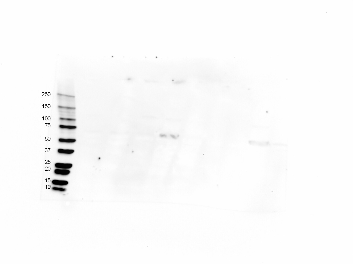 TfR (Transferrin R) Antibody (DF1513) NBP2-32945