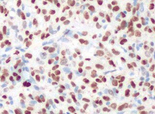 TTF-1 / NKX2-1 Antibody (SPM150) NBP2-32999