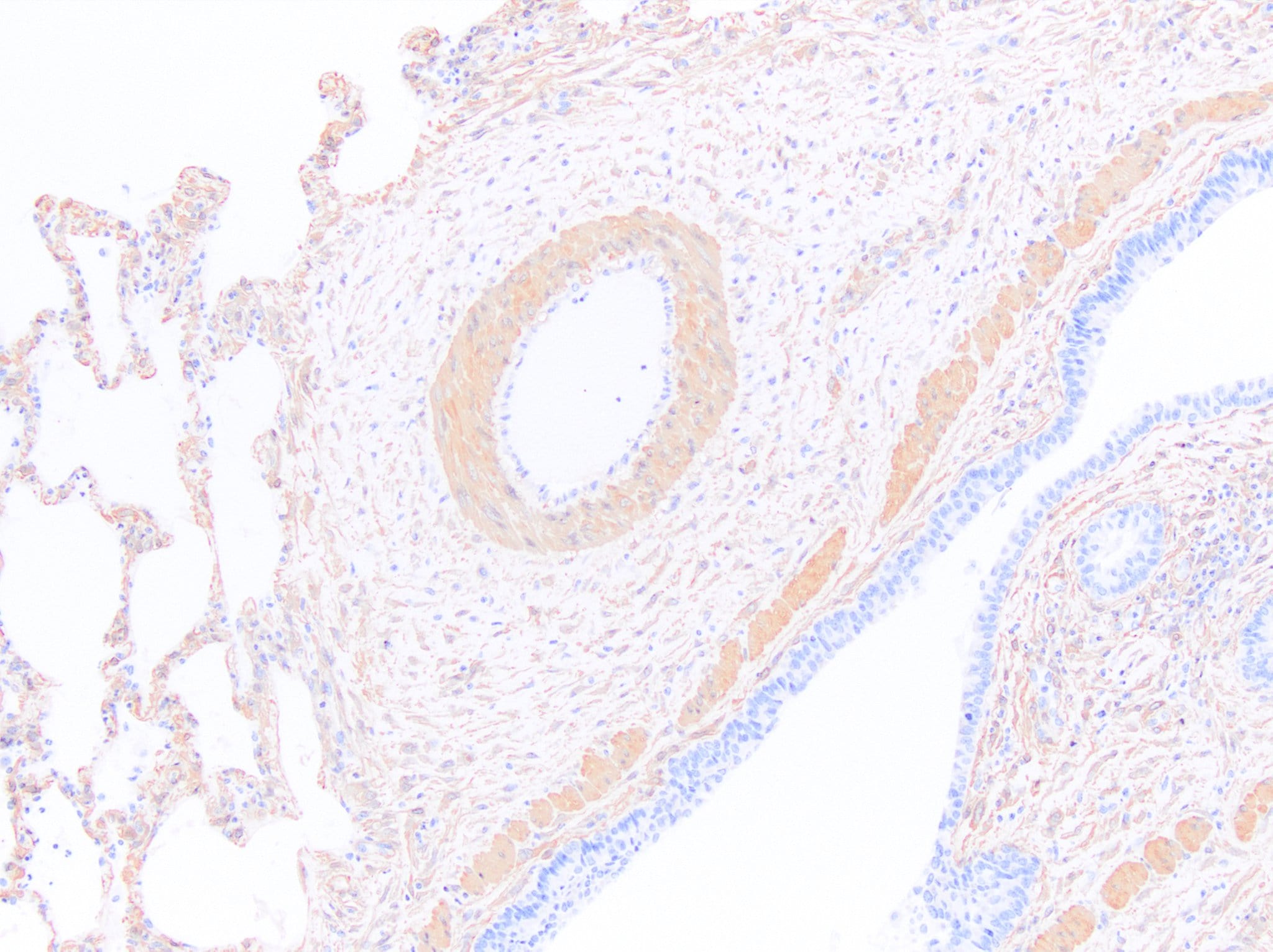 alpha-Smooth Muscle Actin Antibody (1A4/asm-1) - BSA Free NBP2-33006