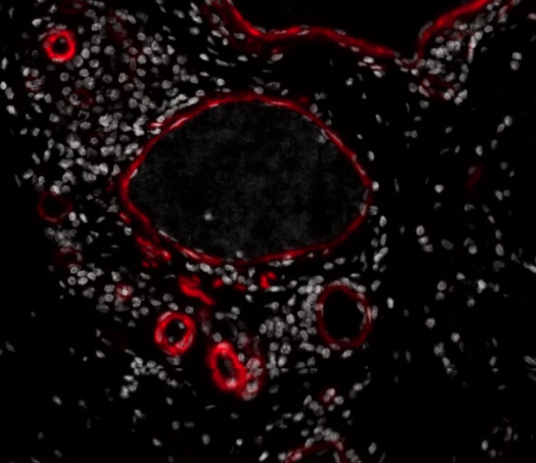 alpha-Smooth Muscle Actin Antibody (1A4/asm-1) [Alexa Fluor® 750] NBP2-33006AF750