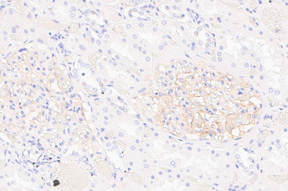 CD35 Antibody (E11) [Biotin] NBP2-33080B