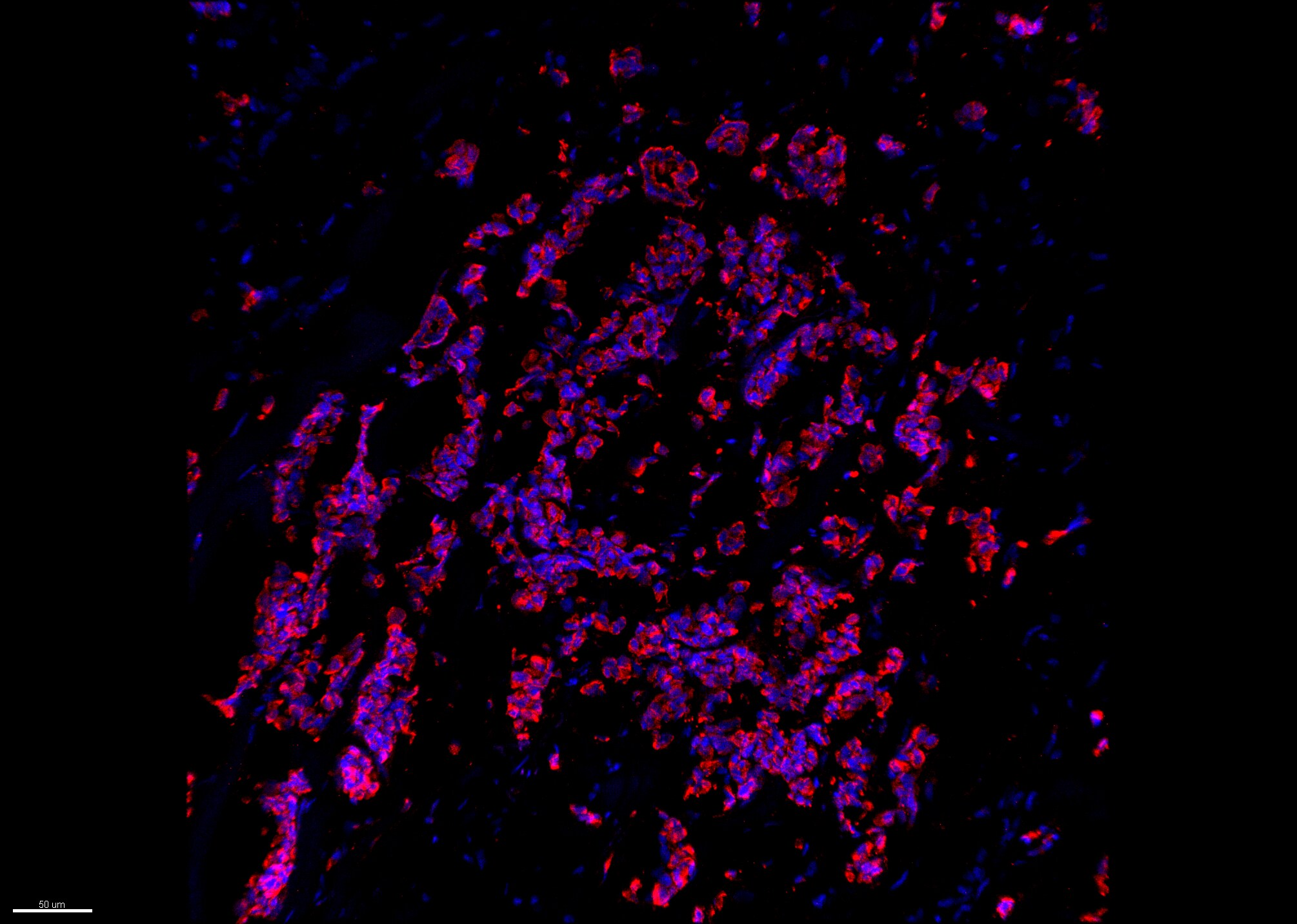 Cytokeratin 19 Antibody (A53-B/A2.26) [Janelia Fluor® 549] NBP2-33134JF549