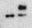 Uroplakin II Antibody - BSA Free NBP2-33389