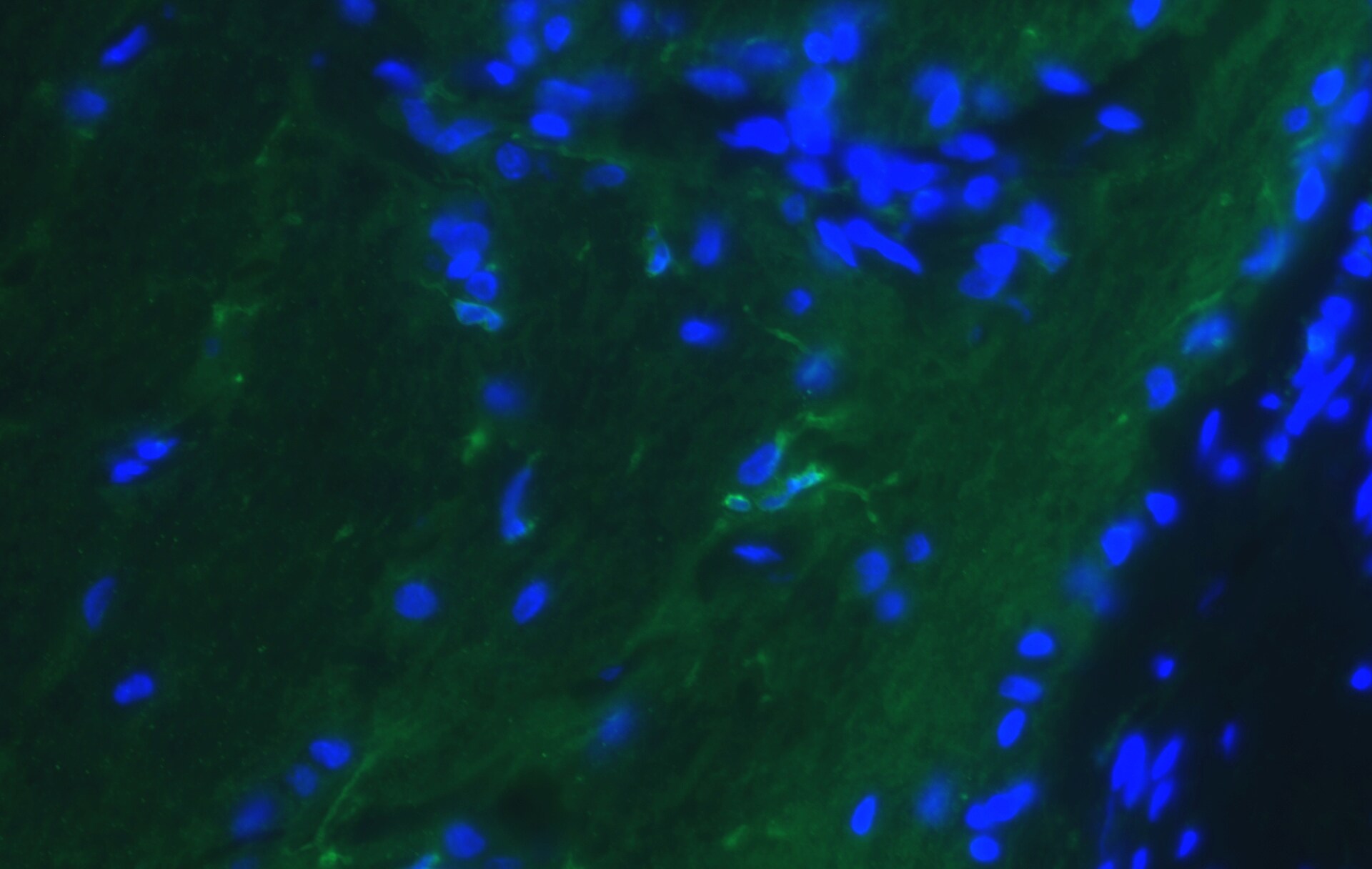 P2Y12/P2RY12 Antibody - BSA Free NBP2-33870