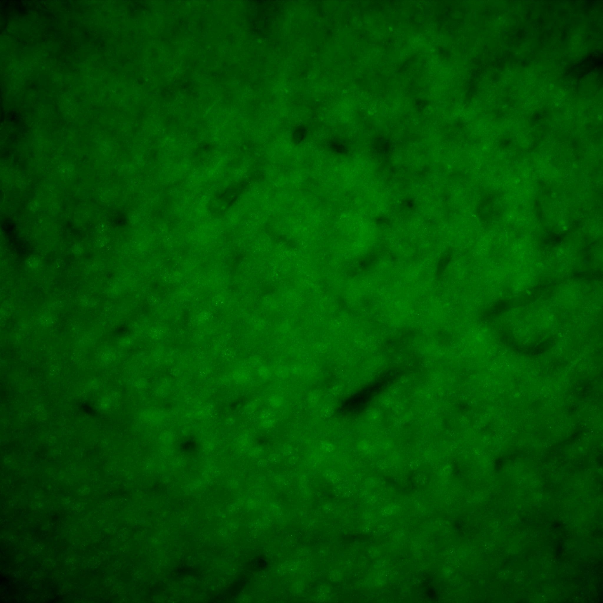 P2Y12/P2RY12 Antibody - BSA Free NBP2-33870