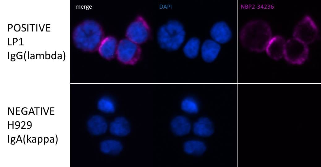 Lambda Light Chain Antibody (LcN-2 + ICO-106) NBP2-34236