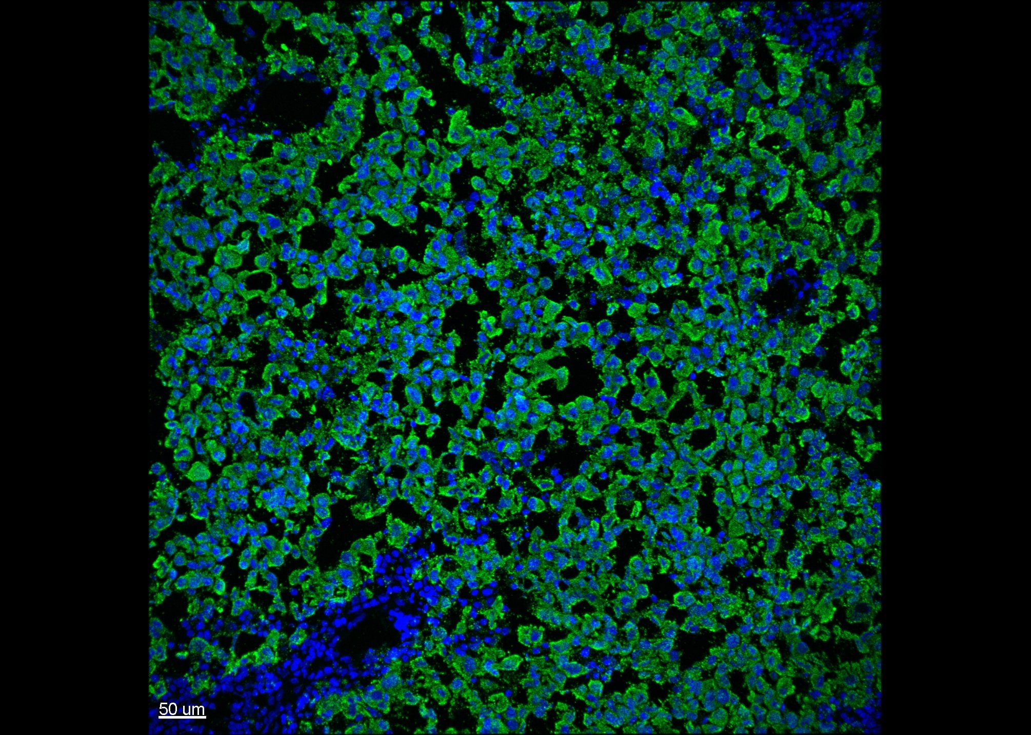 Melan-A/MART-1 Antibody (DT101 + BC199) NBP2-34246
