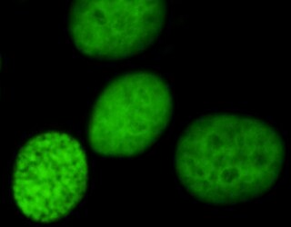Ku70/XRCC6 Antibody (KU729) NBP2-34247