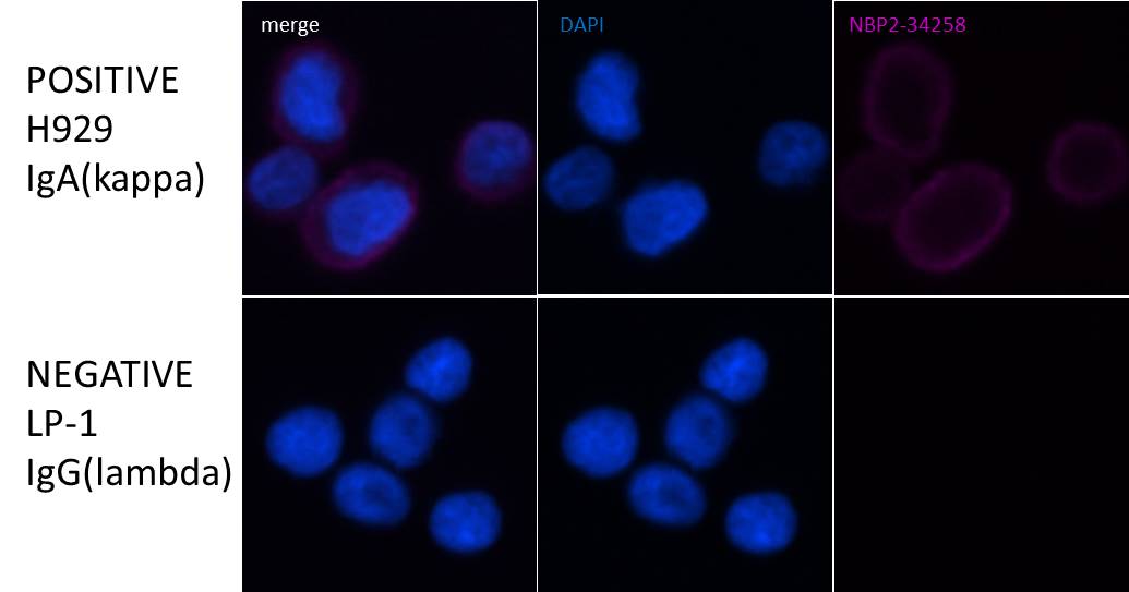 Kappa Light Chain Antibody (HP6053 + L1C1) NBP2-34258