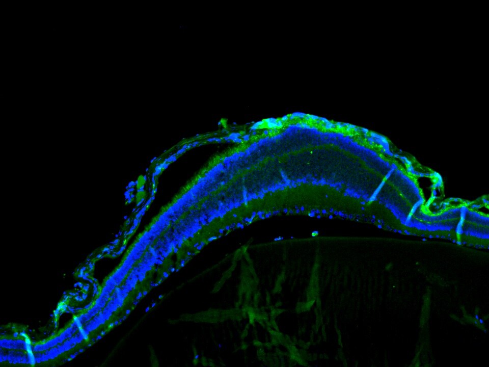 Insulin Antibody (E2-E3 (same as INS04)) NBP2-34260