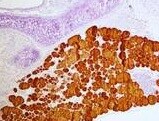 Thyroglobulin Antibody (2H11 + 6E1) NBP2-34294