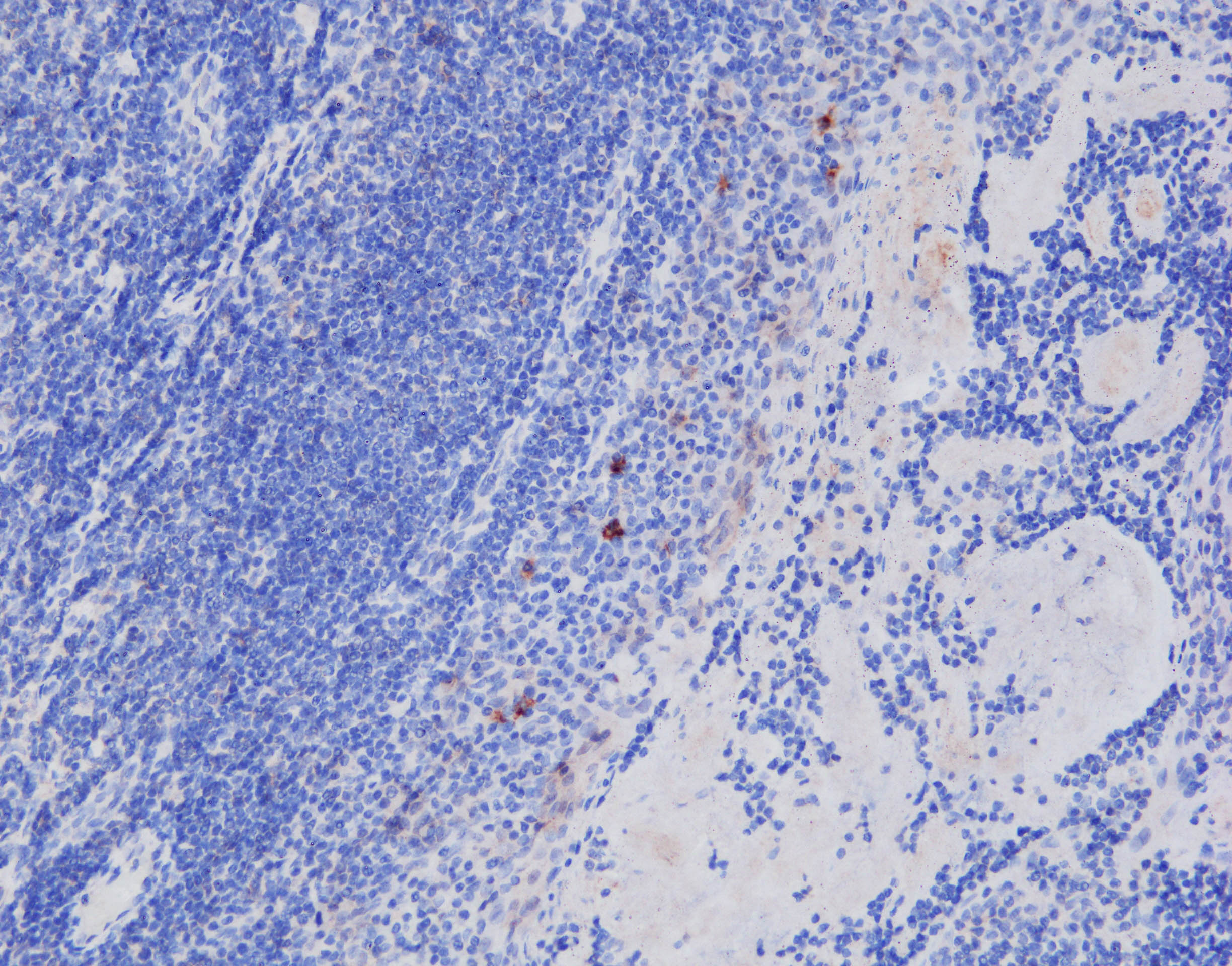 CD1a Antibody (O10+C1A/711) NBP2-34314