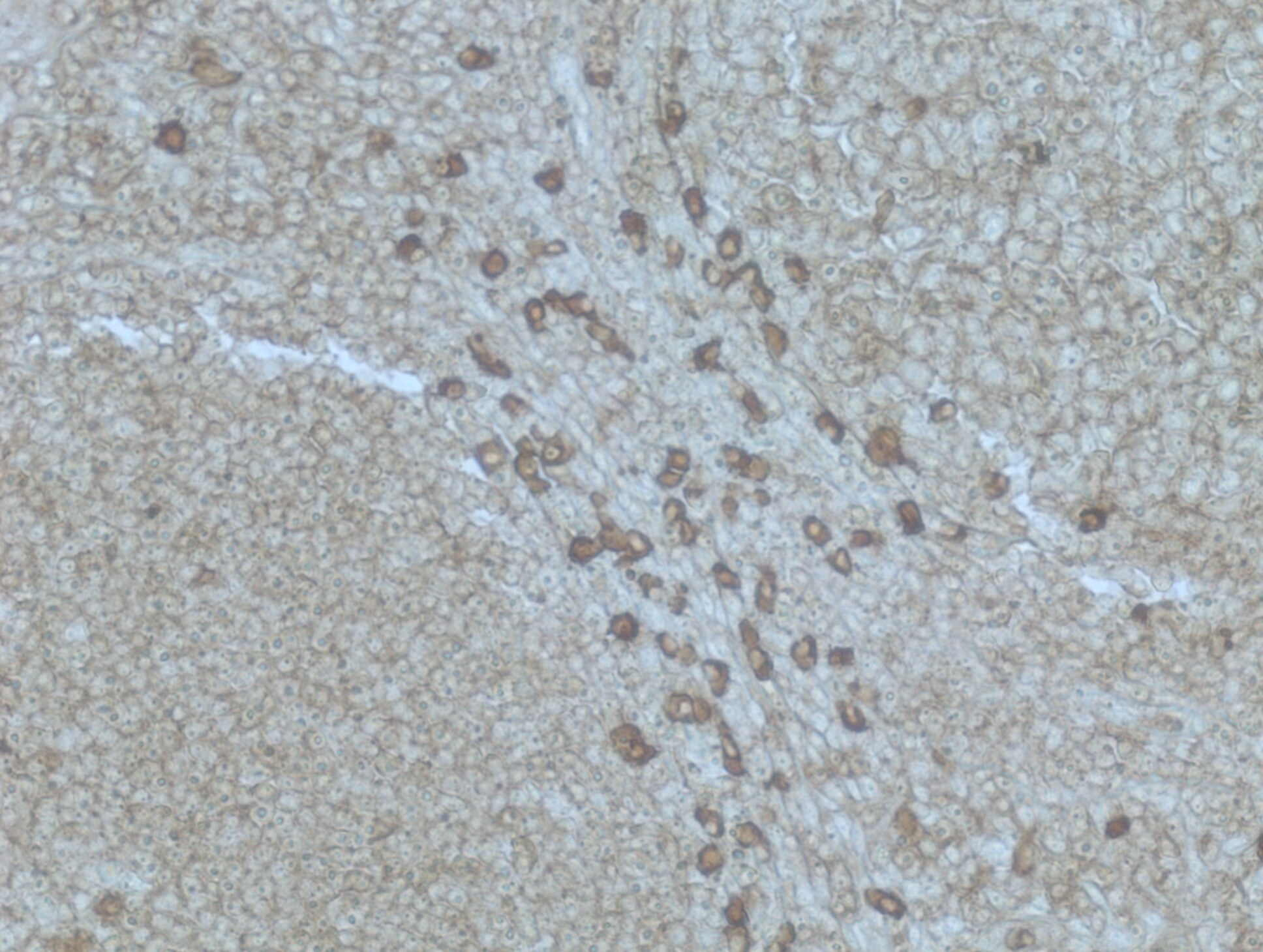 Plasma Cell Marker Antibody (SPM310) NBP2-34359