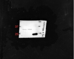 Thymidylate Synthase Antibody (SPM453) NBP2-34390