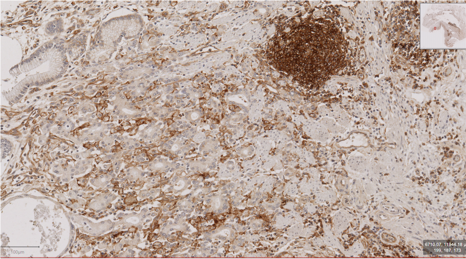 CD40/TNFRSF5 Antibody (CL1673) - BSA Free NBP2-34488