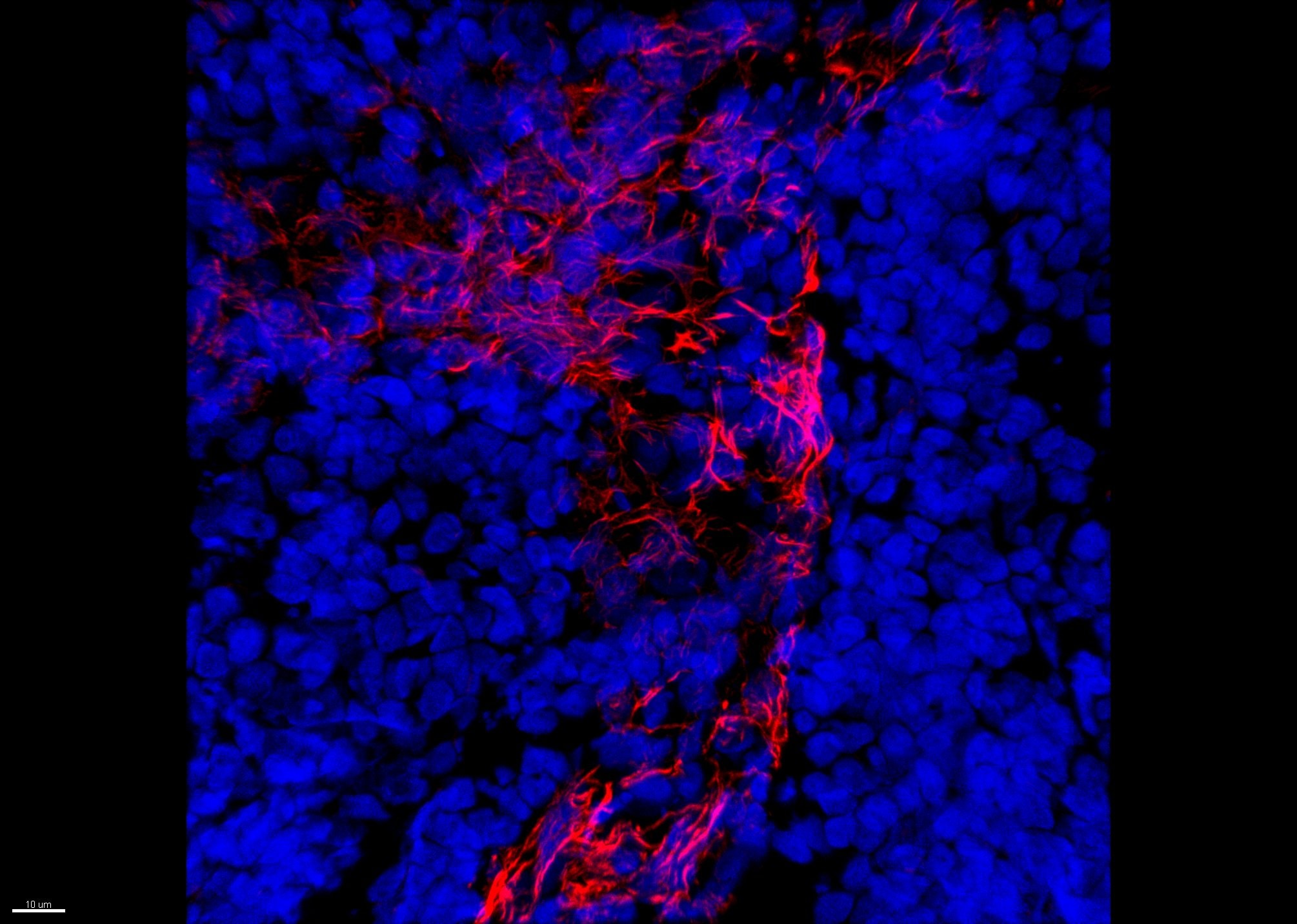 alpha-Smooth Muscle Actin Antibody (1A4/asm-1) [Janelia Fluor® 549] NBP2-34522JF549