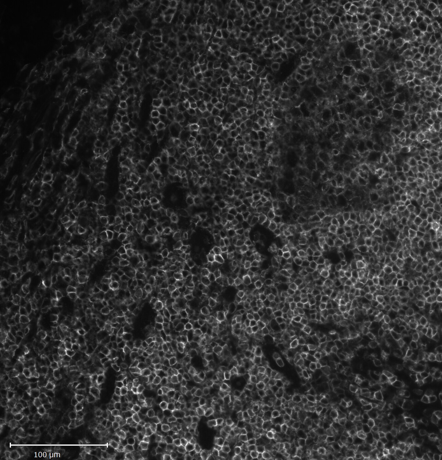 CD45 Antibody (2B11 + PD7/26) - Azide and BSA Free NBP2-34528