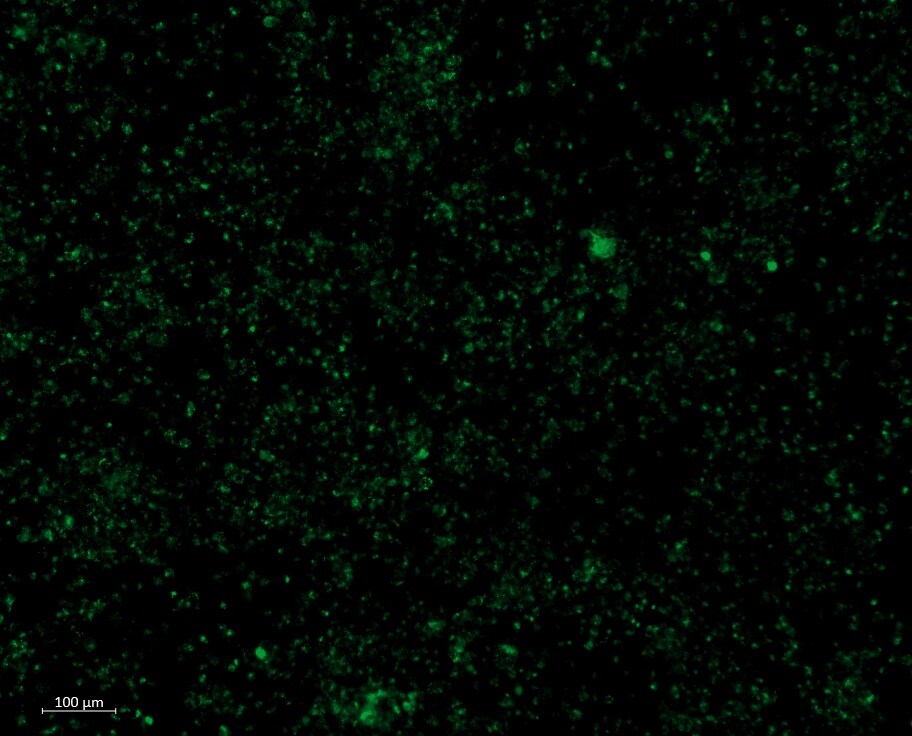 CEACAM5/CD66e Antibody (CEA31) - Azide and BSA Free NBP2-34594
