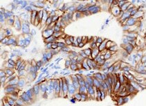 CEACAM5/CD66e Antibody (CEA31) - Azide and BSA Free NBP2-34594