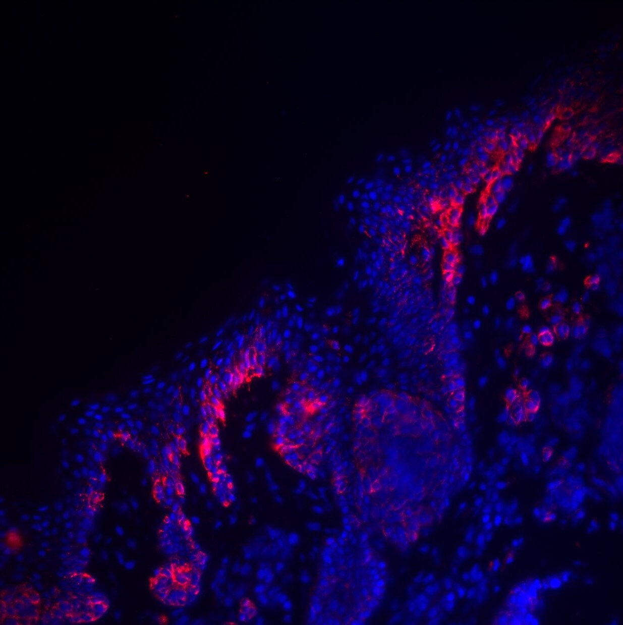 PMEL17/SILV Antibody (HMB45) [PE] NBP2-34638PE