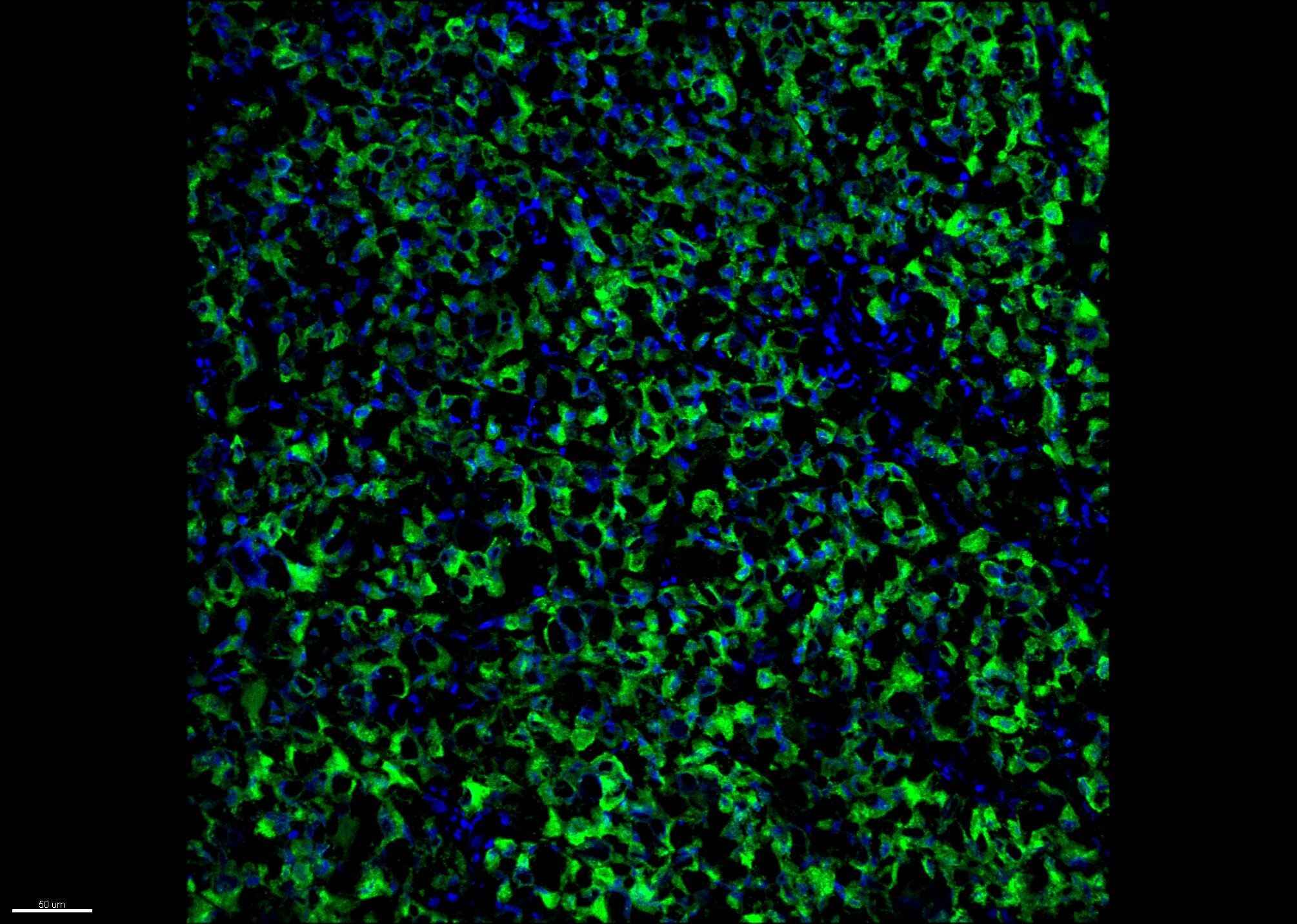 Melanoma Marker (MART-1 + Tyrosinase + gp100) Antibody (M2-7C10 + M2-9E3 + T311 + HMB45) [Alexa Fluor® 488] NBP2-34681AF488