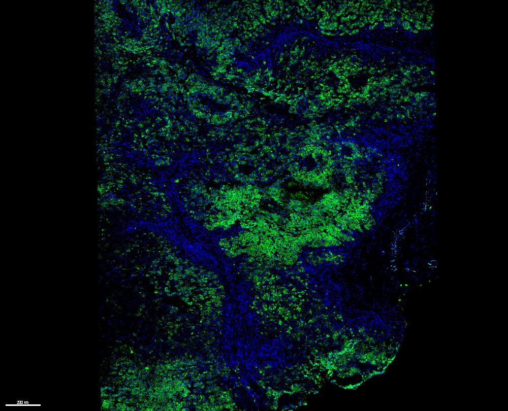 Melanoma Marker (MART-1 + Tyrosinase + gp100) Antibody (M2-7C10 + M2-9E3 + T311 + HMB45) [Janelia Fluor® 549] NBP2-34681JF549
