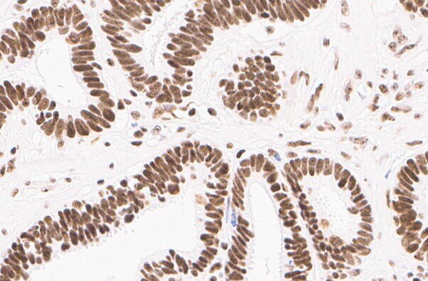 Nucleoli Marker Antibody (NM95) [Biotin] NBP2-34695B