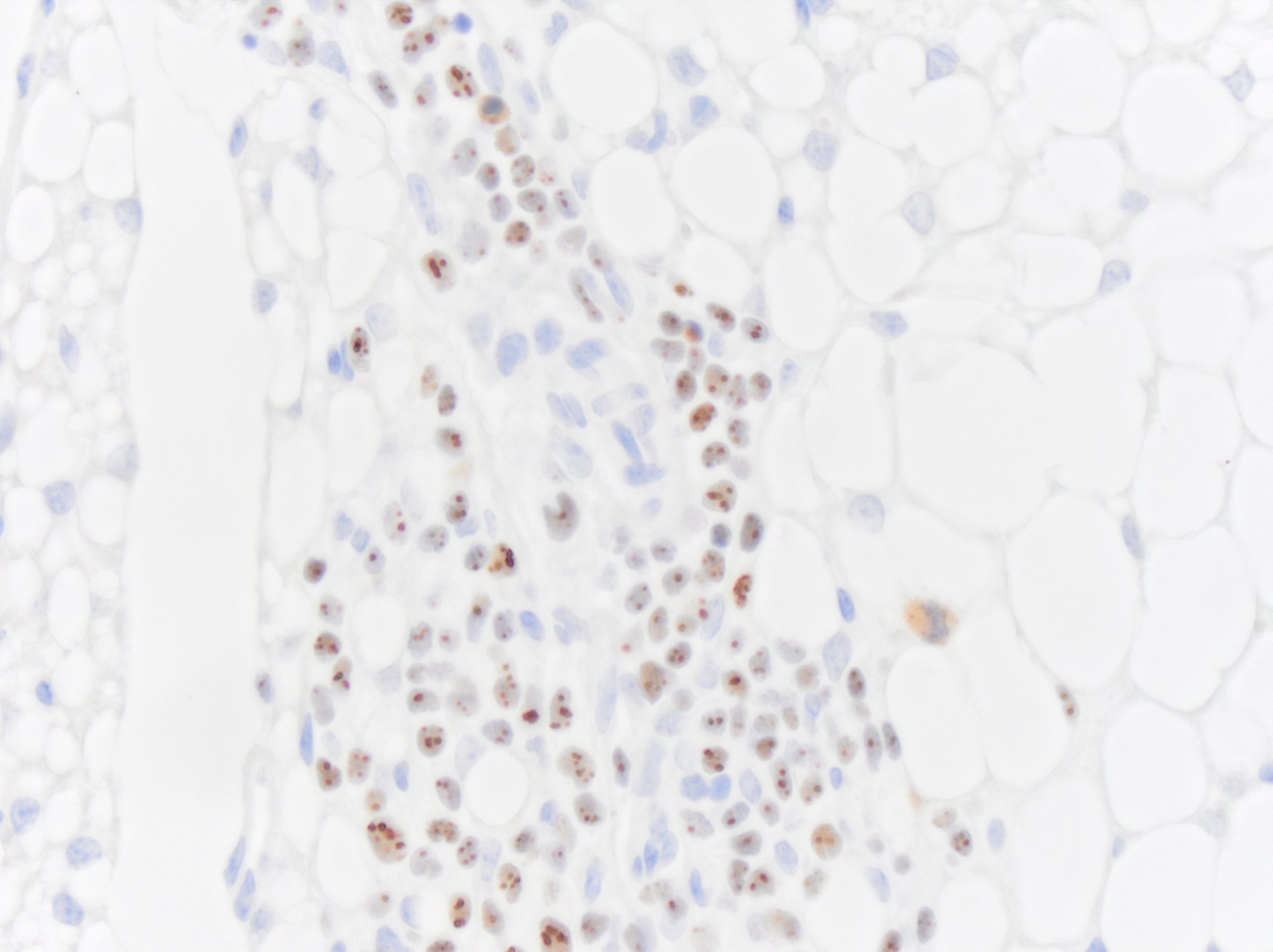Nucleoli Marker Antibody (NM95) [Biotin] NBP2-34695B