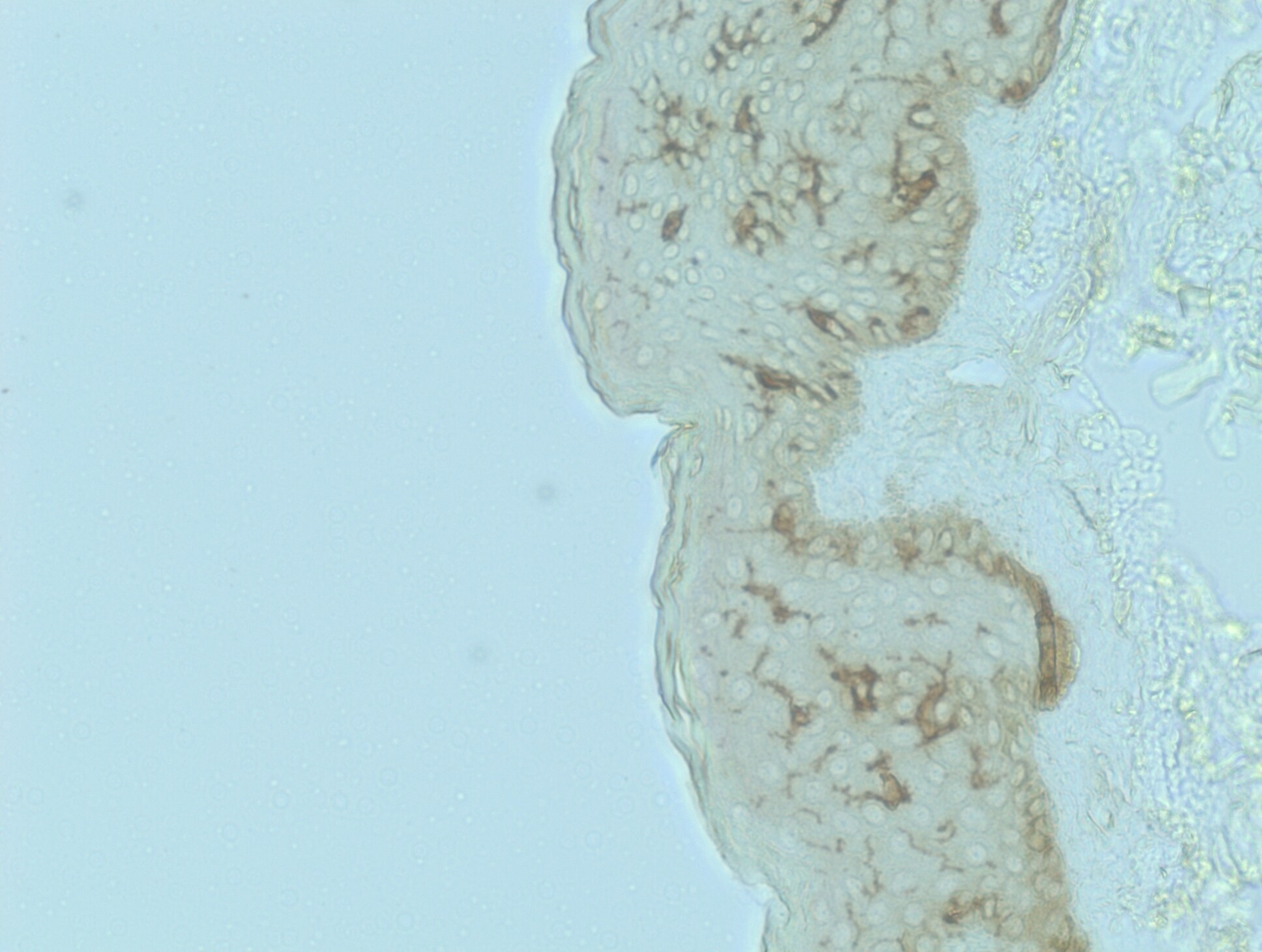 CD1a Antibody (O10) - Azide and BSA Free NBP2-34697