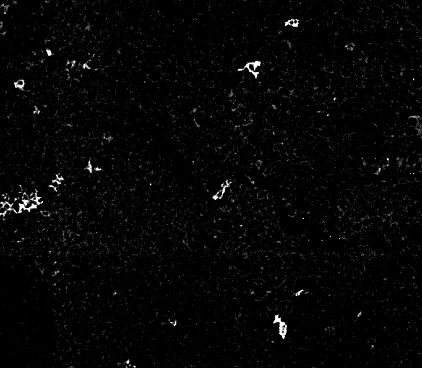 CD1a Antibody (O10+C1A/711) - Azide and BSA Free NBP2-34698