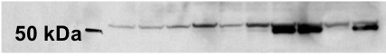 Ornithine Decarboxylase Antibody (ODC1/485) [DyLight 488] NBP2-34700G