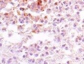 CDC2/CDK1 Antibody (2G9) NBP2-37626